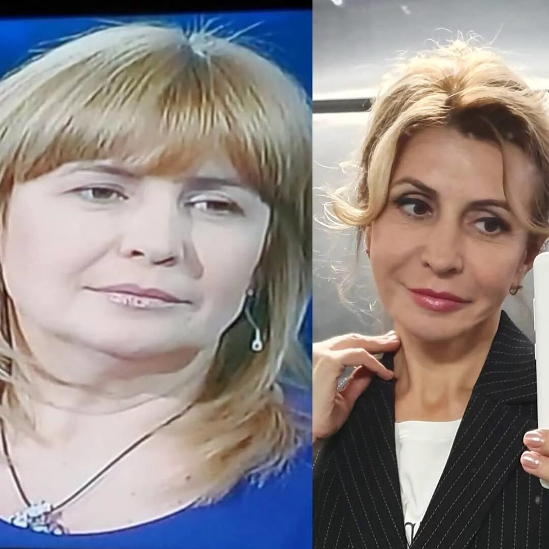 Ирина агибалова жалеет о пластической операции. ирина агибалова – неудачная пластическая операция, фото до и после агибалова ирина александровна до после похудения