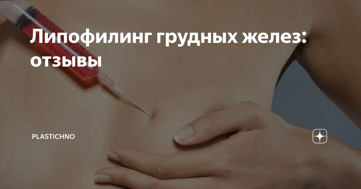 Липофилинг грудных желез – простой метод коррекции бюста