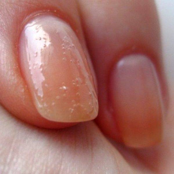 Почему лак на ногтях пузырится: причины и исправление маникюра