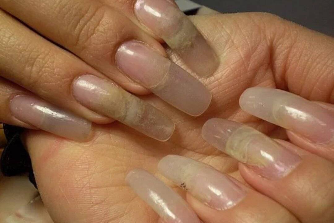 Почему отслаиваются нарощенные ногти? – все о красоте и не только