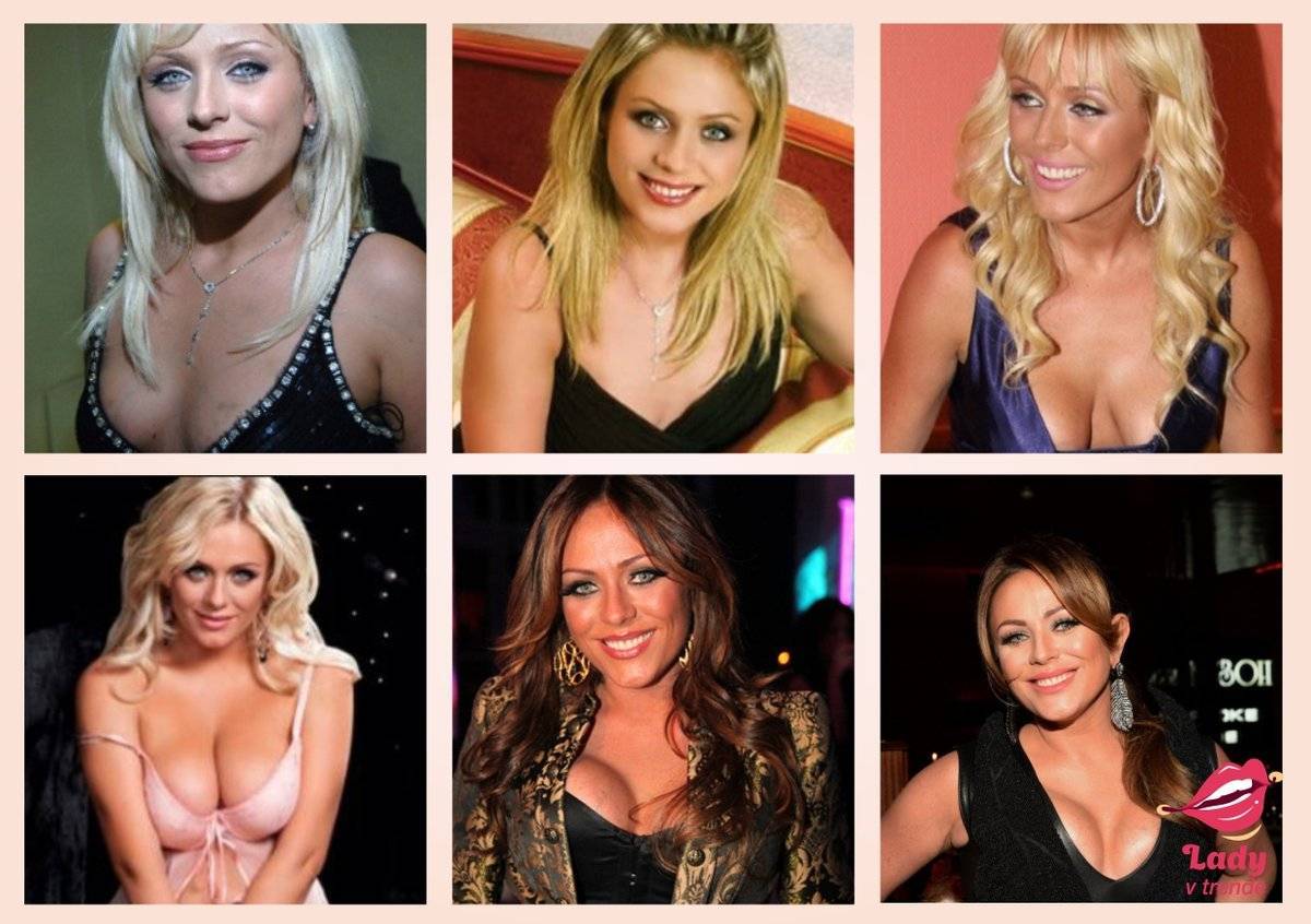 Звезды уменьшают грудь: фото до и после