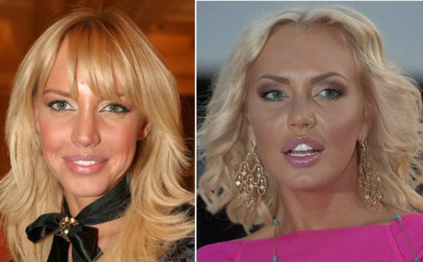 Малиновская маша до и после пластики, неудачная операция, внешность в 2017, почему она стала жертвой