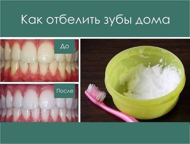 Как почистить зубы без. Отбеливание зубов. Как отбелить зубы в домашних.