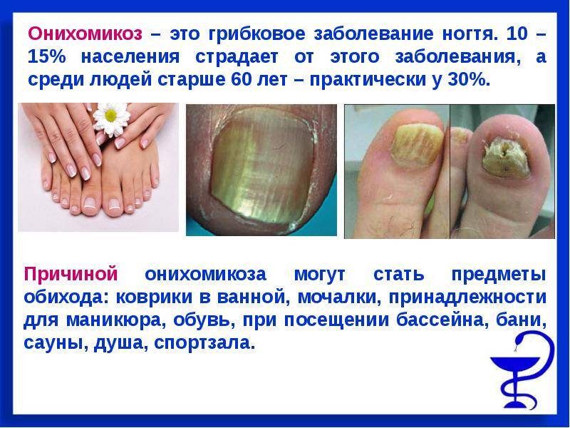 Грибковые инфекции (микозы кожи и слизистых, ногтей )