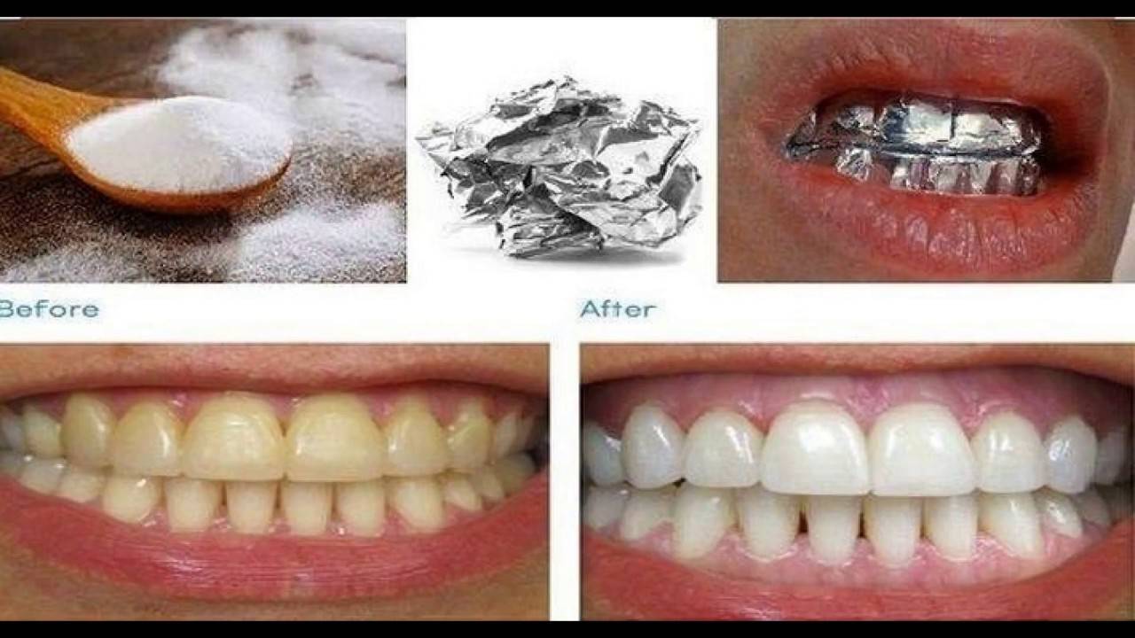 Как можно отбелить зубы в домашних условиях. Отбеливание зубов домашнее отбеливание. Кауотбелить зубы.