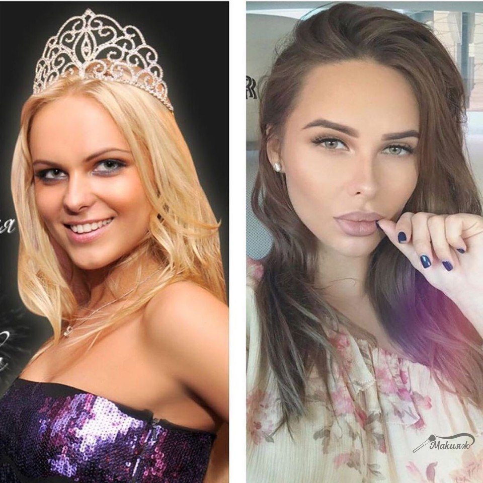 Ханна до и после пластики, фото певицы без макияжа, новости и фото 2021