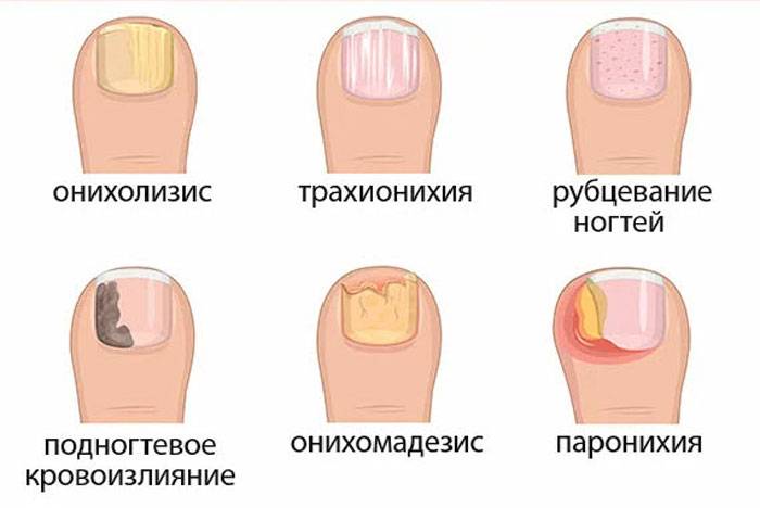 Лунки на ногтях: значение для здоровья