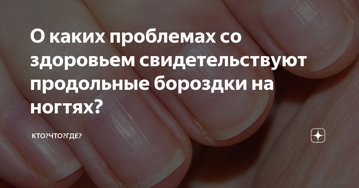 Почему на ногтях появились бугорки и впадины