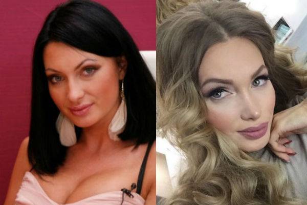 Феофилактова евгения. фото до и после пластики