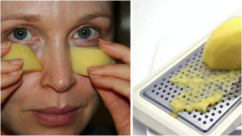Самые эффективные рецепты картофельных масок для глаз