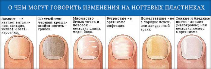 Черные полоски на ногтях: опасны или нет, надо ли лечить и чем это делать - beauty hub