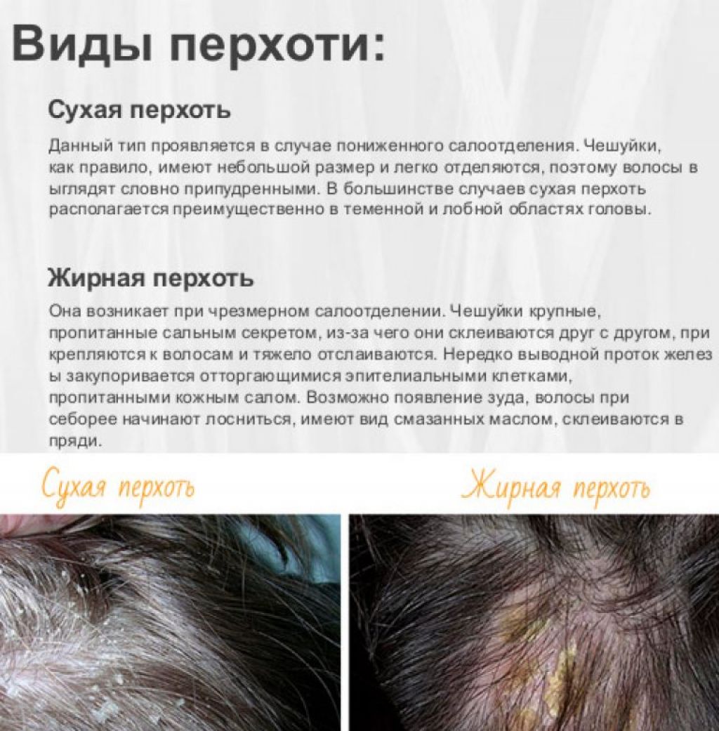 Средство от выпадения волос после родов: как остановить