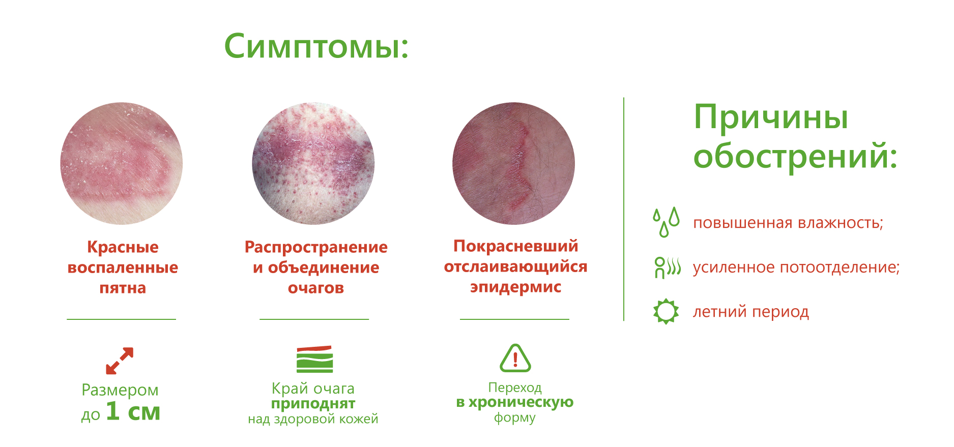 Пиодермия: симптомы, диагностика, лечение - врачебная династия