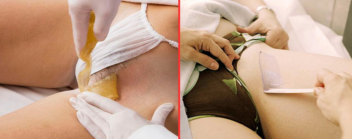 Как вы делаете эпиляцию в зоне бикини во время беременности