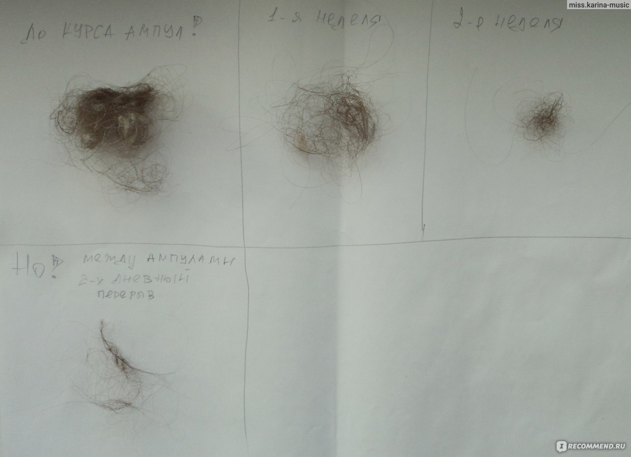 Норма выпадения волос в день у женщин при мытье и расчесывании