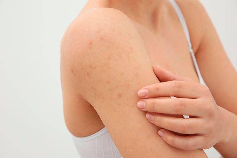 Как состояние желудочно-кишечного тракта влияет на состояние кожи