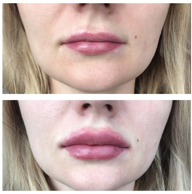 Почему уходят губы. Перманентный макияж на тонкие губы. Перманент губ до и после. Перманентный макияж губ на тонких губах.