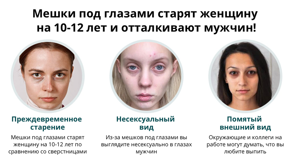 Как убрать темные круги под глазами