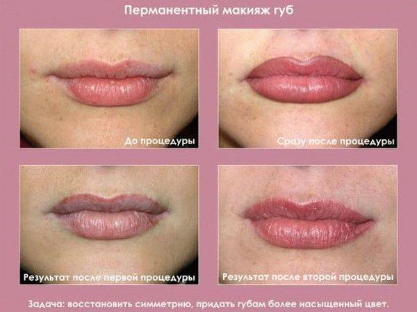 Татуаж губ: виды, фото до и после. отзывы женщин о процедуре