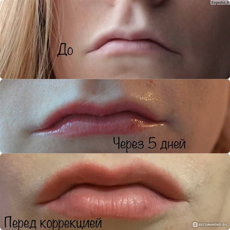 Перманентный татуаж губ: отзывы, фото до и после процедуры