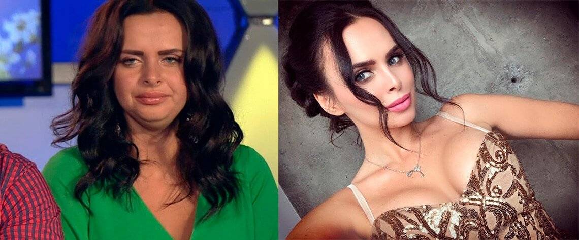 Виктория романец до и после пластики носа, похудения | marykay-4u.ru