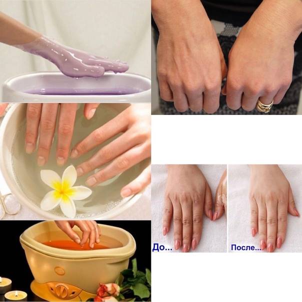 Парафинотерапия рук - как правильно применять процедуру • журнал nails