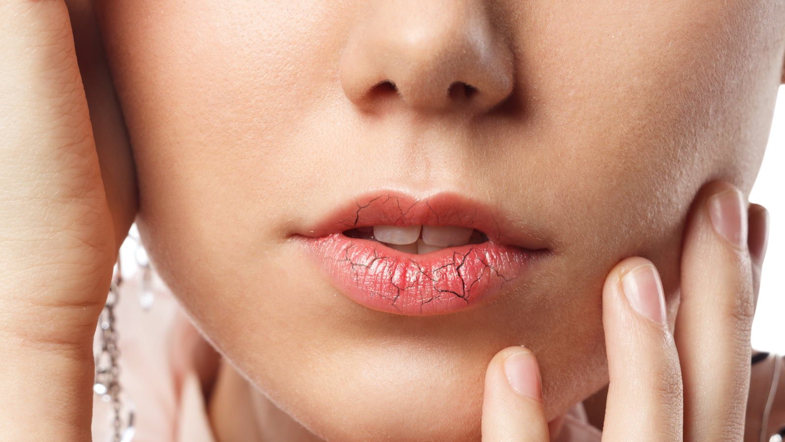 Что делать, если губы постоянно сухие?