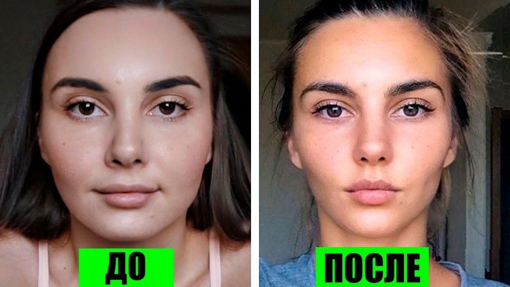 Как сделать худое лицо с помощью филлеров, особенности и преимущества 3д моделирования лица