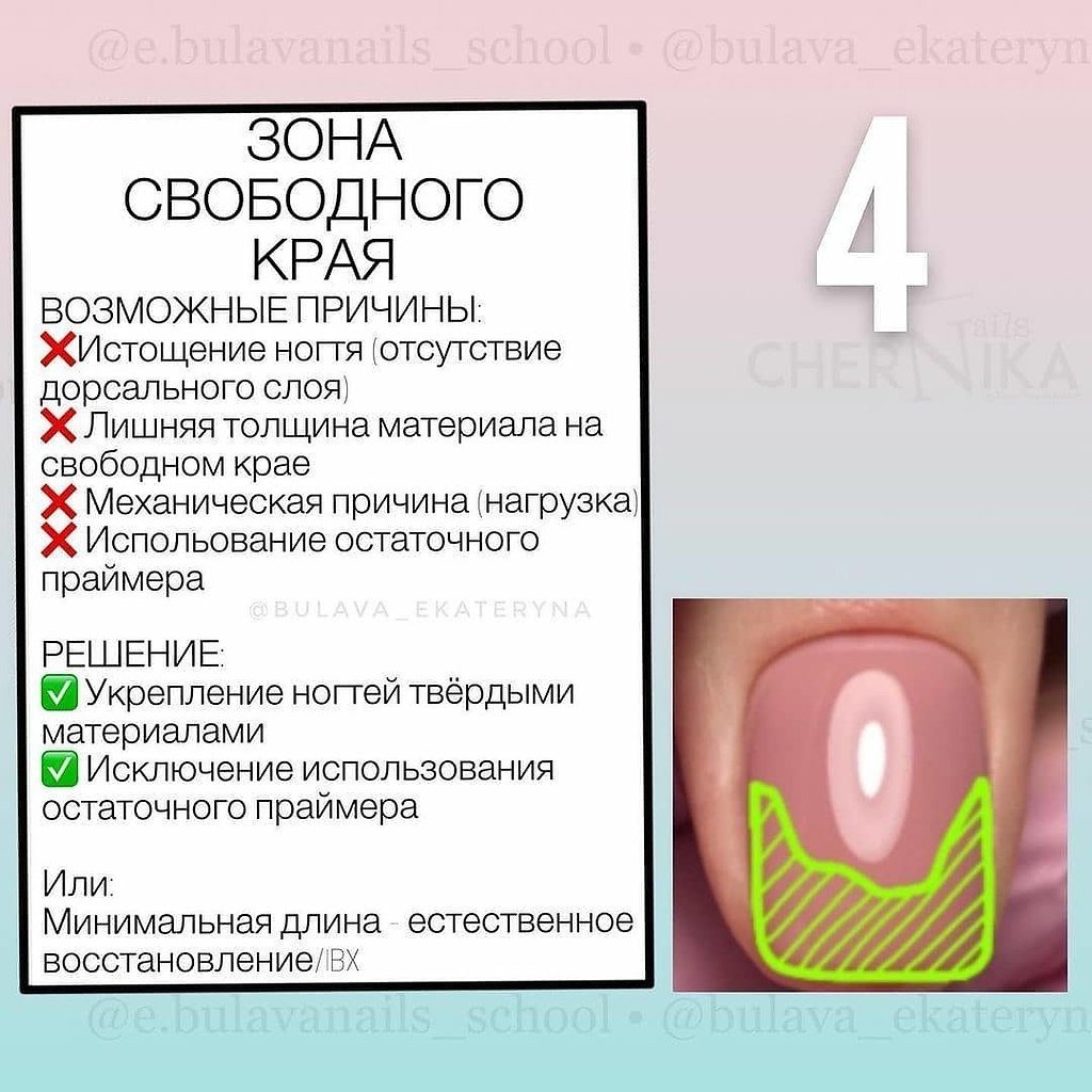 Почему гель-лак не держится на ногтях и отходит: возможные причины
