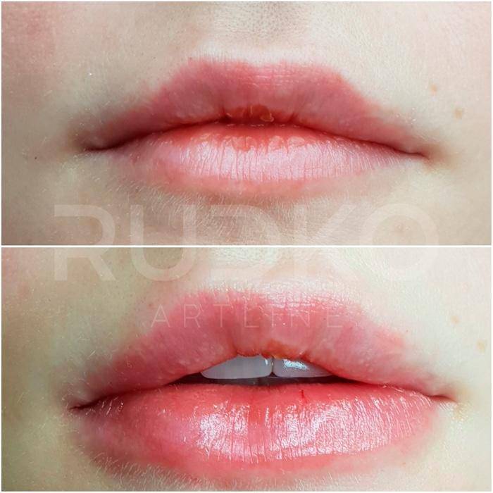 Татуаж или увеличение губ. Перманентный макияж губ асимметрия губ. Увеличение губ перманентным макияжем. Татуаж губ на увеличенные губы.
