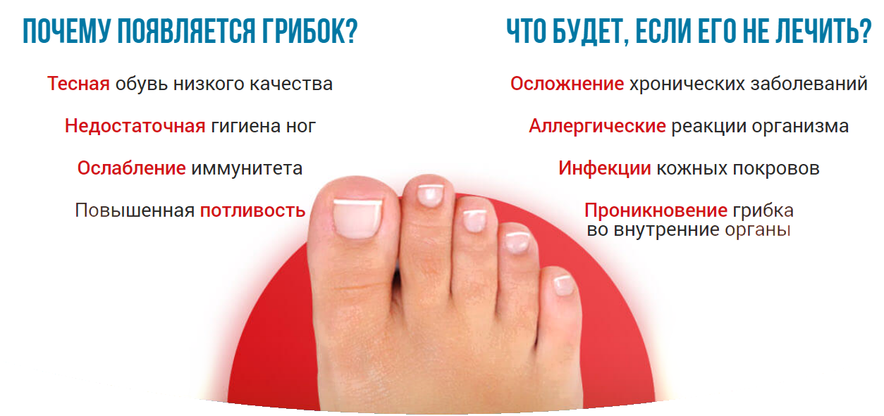 Грибок ногтей на ногах и руках: причины, первые признаки, основные симптомы. лечение онихомикоза в москве