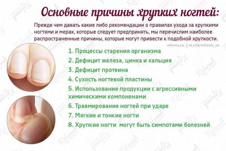 Мази и гели при артрозе - нолтрекс.
