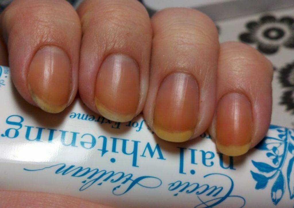 Как отбелить ногти в домашних условиях? — modnail.ru — красивый маникюр