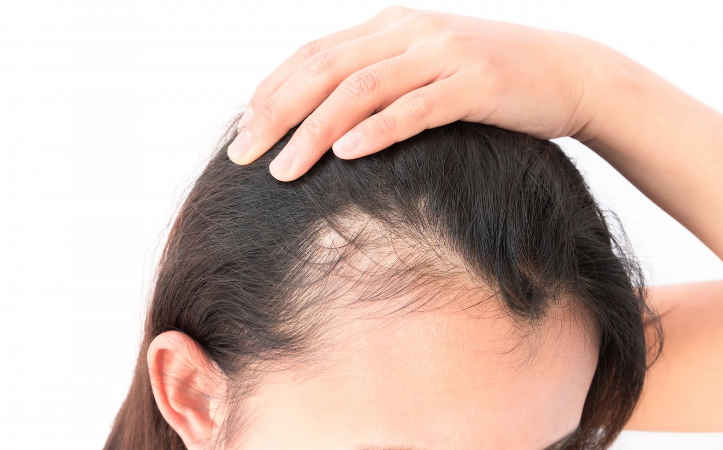 Советы трихолога для роста волос | блог клиники медиэстетик