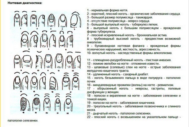 Диагностика по ногтям - признаки для определения заболевания по изменениям цвета, состояния и твердости
