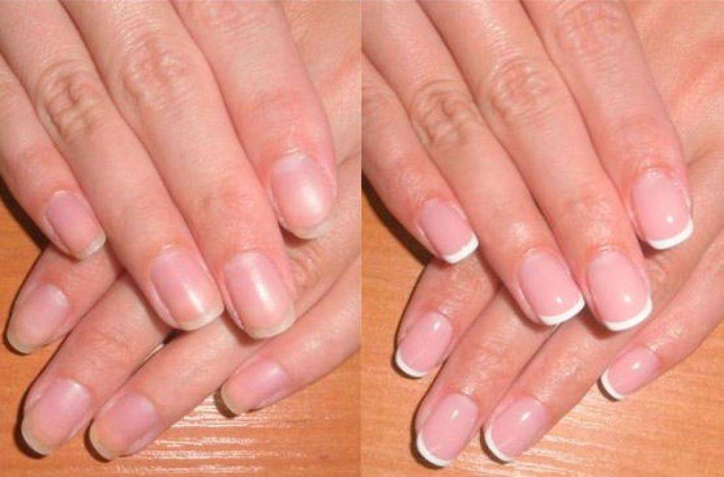 Вред гель-лака для ногтей: чем опасен для здоровья организма