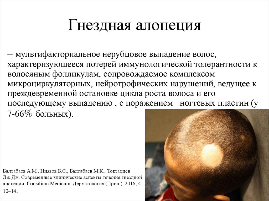 Выпадение волос у мужчин: лечение выпадения волос у мужчин после ковида в самаре в нью лайф