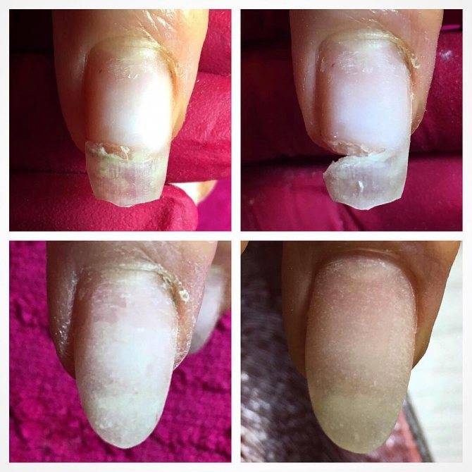 Для тех, кто хочет знать, как приклеить ногти в случае поломки! | красивые ногти - дополнение твоего образа