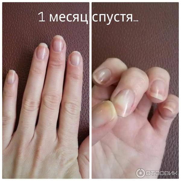 Как отрастить быстро ногти за 2, 3, 5 дней, за неделю, за 2 недели, месяц? как отрастить укрепить ногти в домашних условиях?