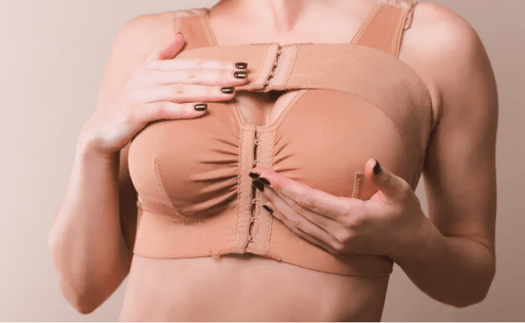 Застой лимфы после удаления груди
