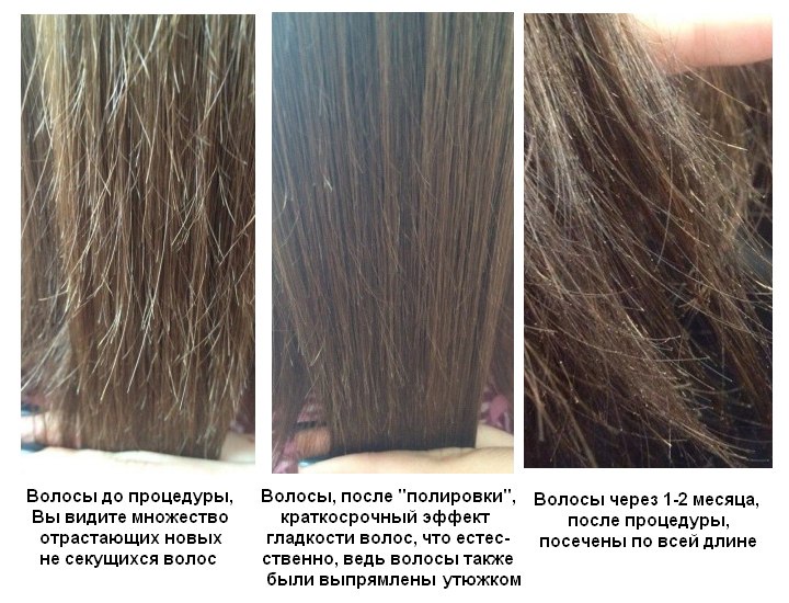 Секущиеся волосы: причины, способы лечения, эффективные средства против сечения в домашних условиях