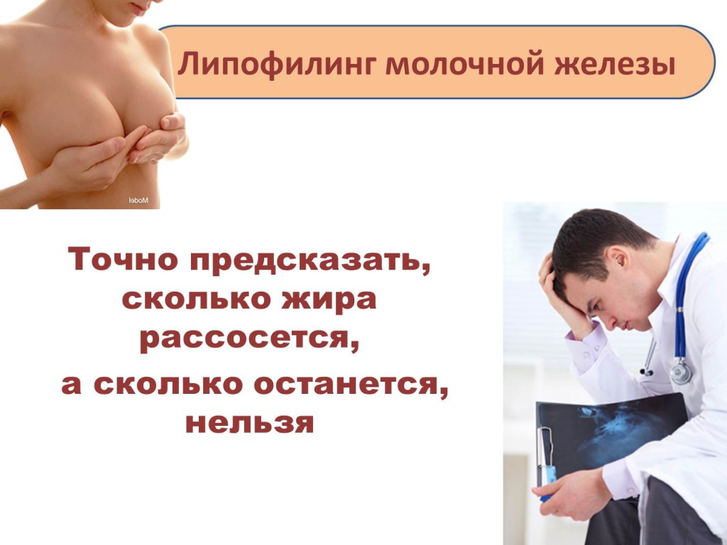 Липофилинг грудных желез: возможности, плюсы и минусы, как проходит, результат и восстановление