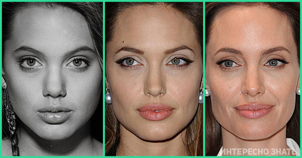 Когда ее лицо становилось лучше. Анджелина Джоли до пластики. Анджелина Джоли пластические операции. Анджелина Джоли ринопластика. Скулы Анджелины Джоли.