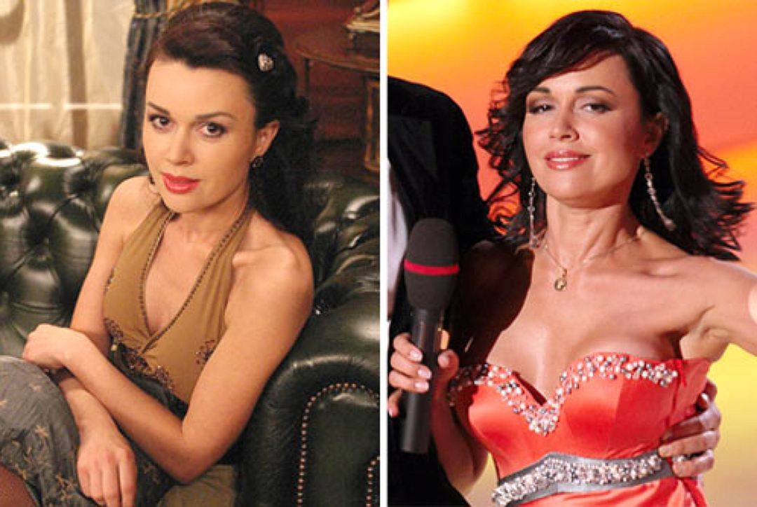 Фото российских знаменитостей и голливудских звезд до и после пластики | qulady