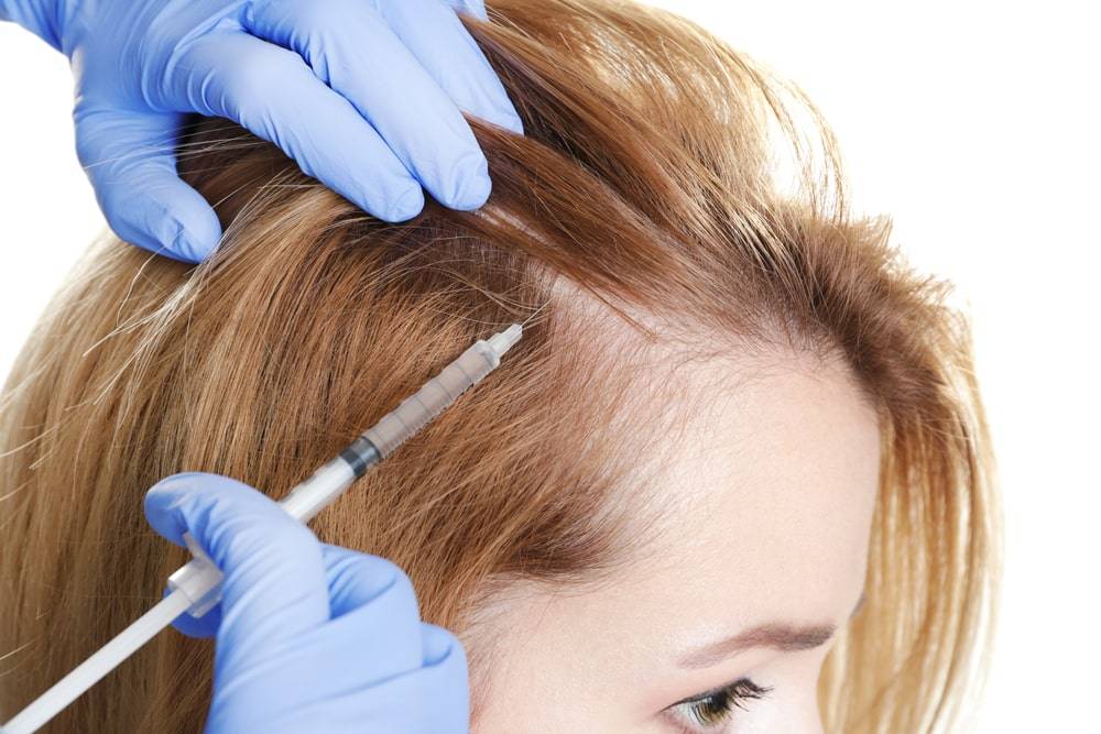 Мезотерапия кожи головы – эффективный способ лечения облысения | сеть клиник линлайн