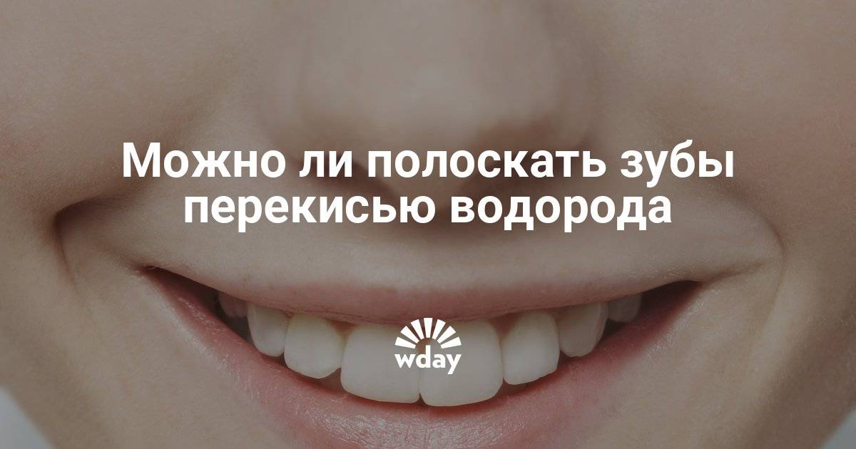 Как безопасно отбелить зубы в стоматологии или дома