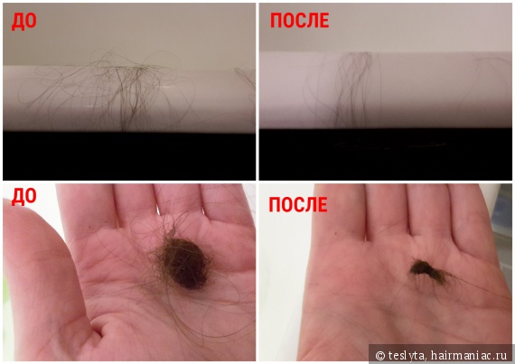 Норма выпадения волос в день: сколько вы теряете волос и каковы причины?
