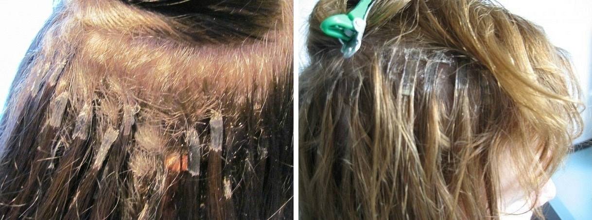 Как восстановить волосы после наращивания? проверенные методы