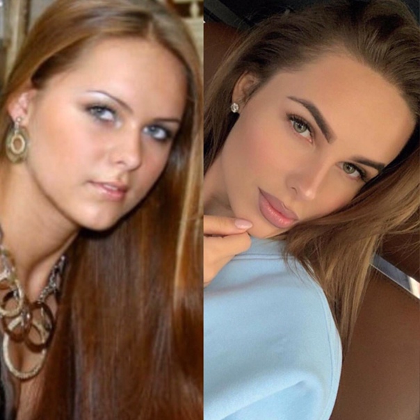 Ханна до пластики фото до и после фото певица