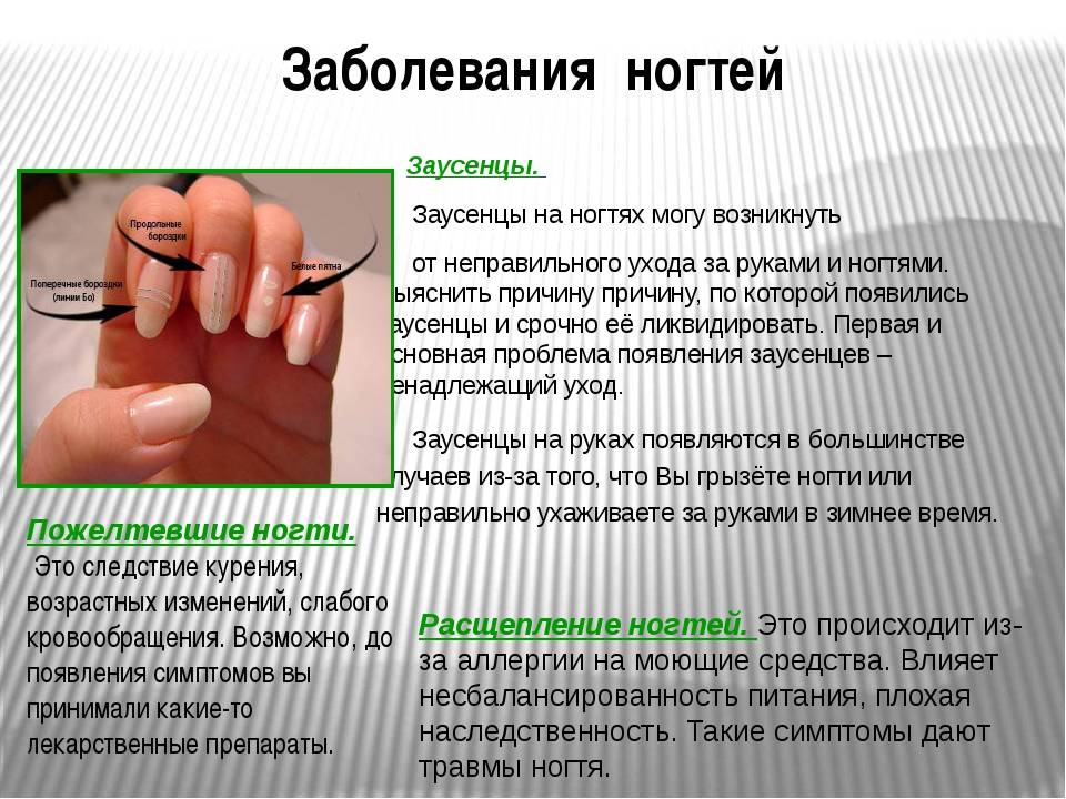 Руководство по заболеваниям и проблемам с ногтями: диагностика, причины и способы устранения 12 болезней